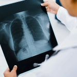 Hospital Buen Samaritano-radiologia - placas - xray